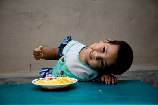 Nutritional Assistance